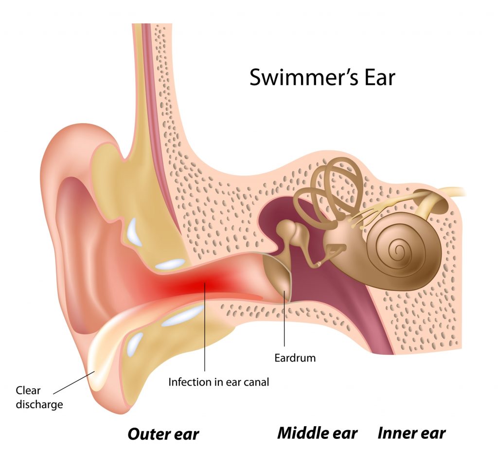 5 Tips to Prevent Swimmer's Ear One with the Water